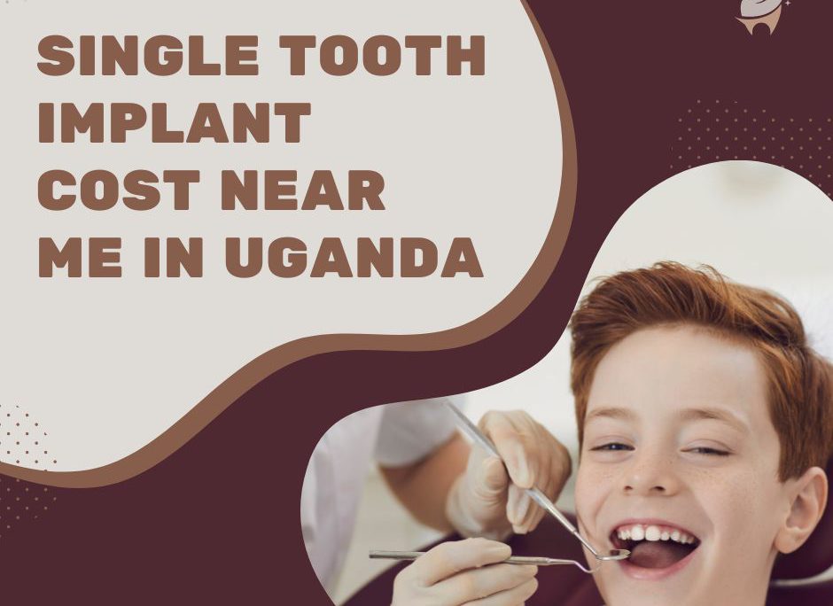 Single Tooth Implant Cost Near Me in Uganda