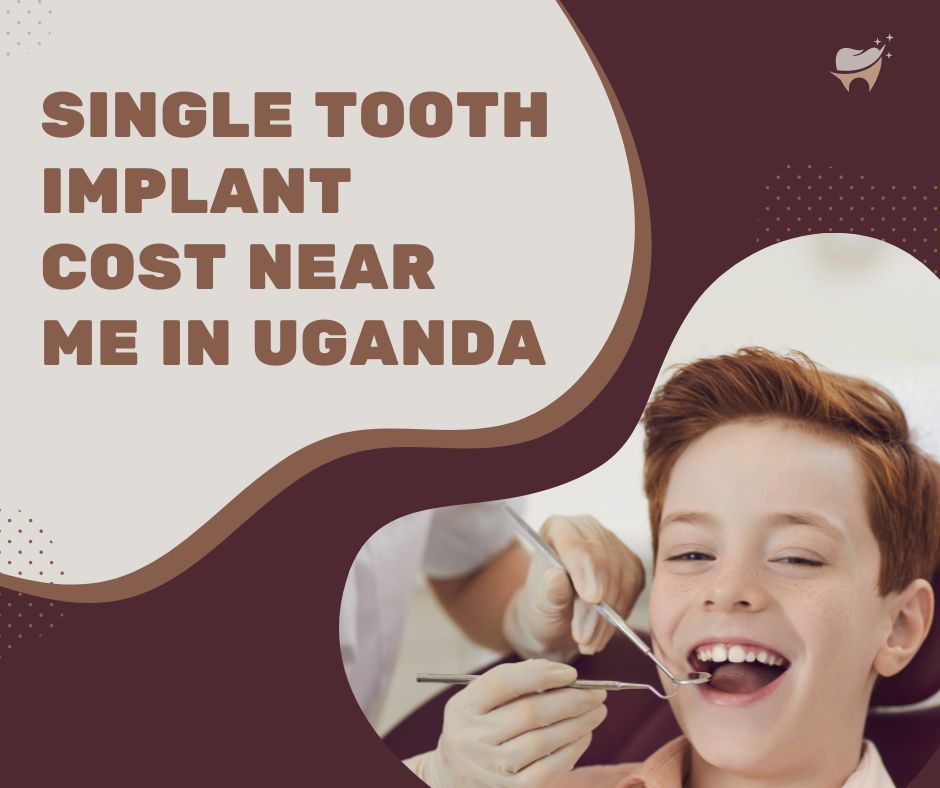 Single Tooth Implant Cost Near Me in Uganda Dental Clinic in Kampala