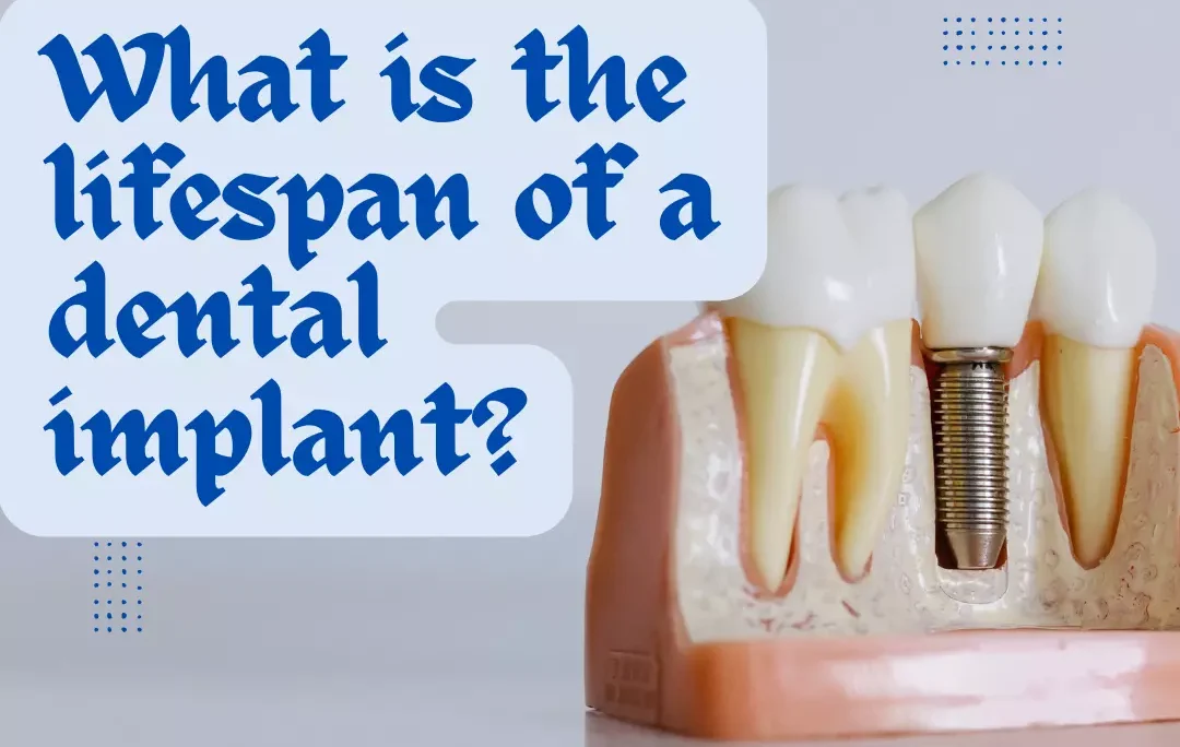 dental implant?